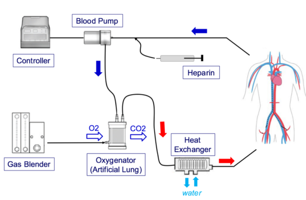 Cardiac-Surgery Project | Compmech