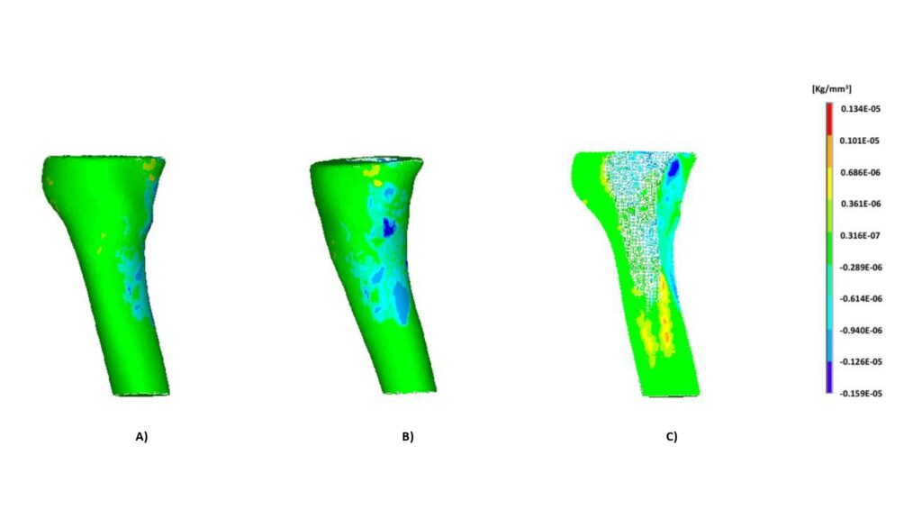 Bone remodelling predicted by the APDL code